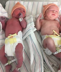 Twin birth story